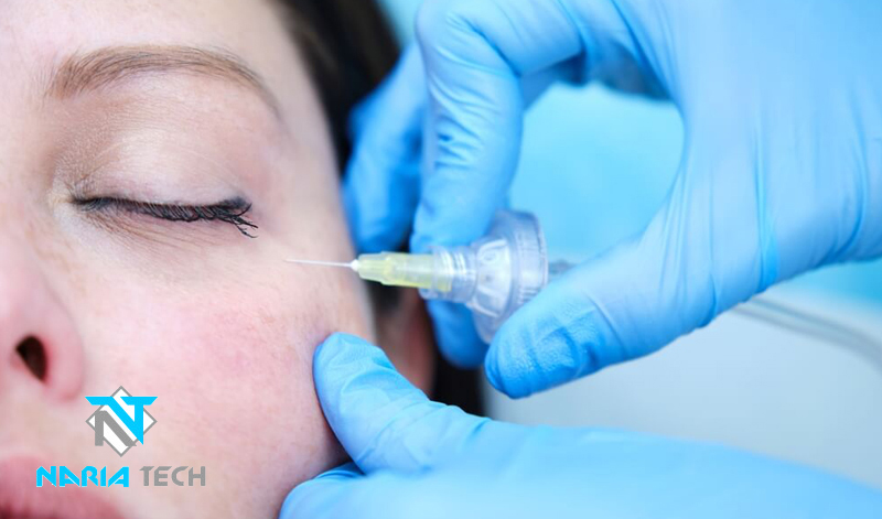 تاثیر کربوکسی تراپی بر درمان تیرگی دور چشم