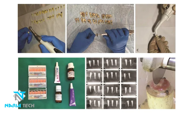 Effect of Cold Plasma on the Penetration Depth of AH26 and Beta Resin Sealers in Dentinal Tubules