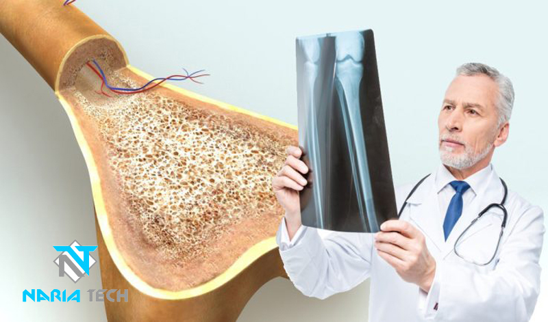 تاثیر صندلی مگنت تراپی در درمان پوکی استخوان